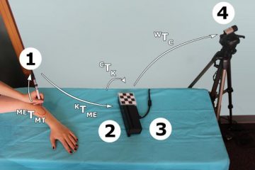 Finding new ways to visualize the body: 3D surgical markings