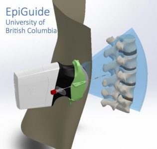 Robotics and Control Lab wins student paper awards at SPIE Medical Imaging 2019